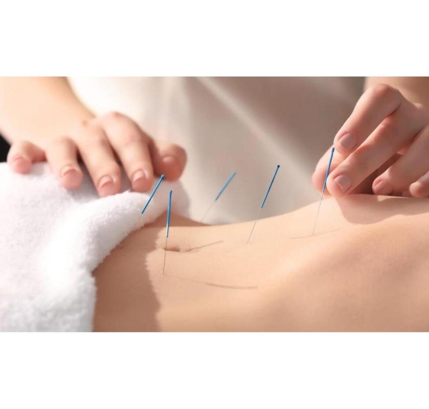 Best Fertility Acupuncture NYC