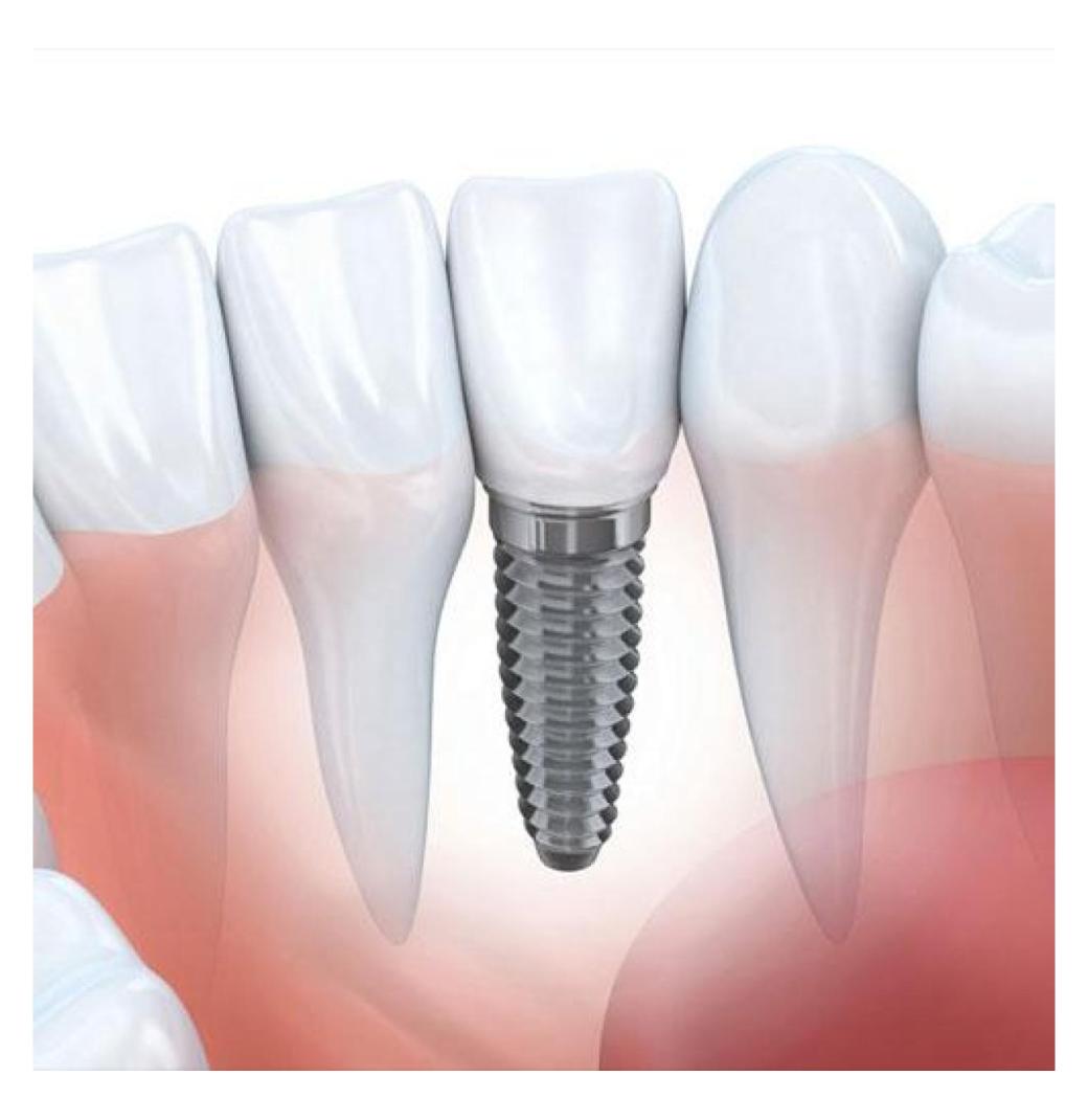Child Dental Benefit Eligibility Canberra