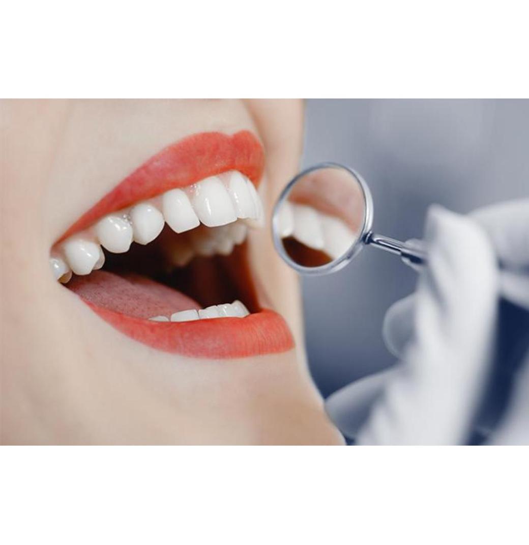Flexible Dental Payment Plan Scheme for Affordable Care
