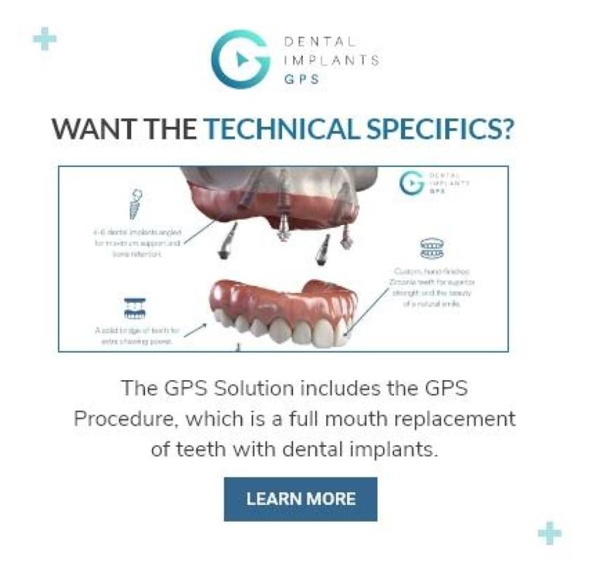 Dental Implants GPS
