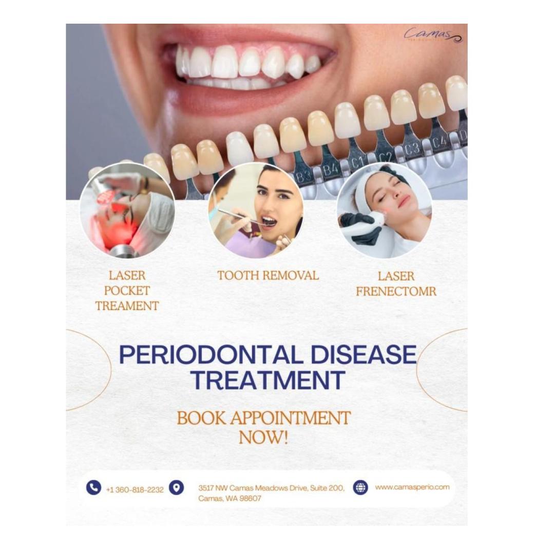 What Is Periodontal Disease Treatment ?