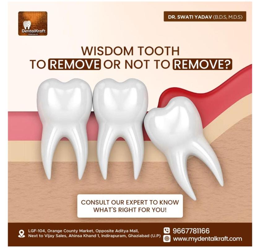 Best Dentist for Tooth Extraction in Indirapuram