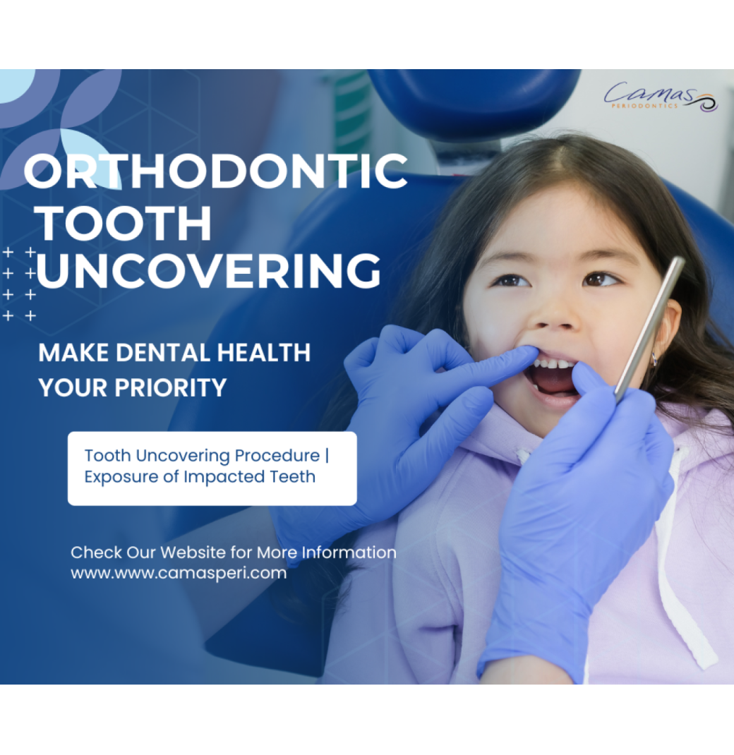 When Is Orthodontic Tooth Uncovering Recommended by Dentists? - 1/3