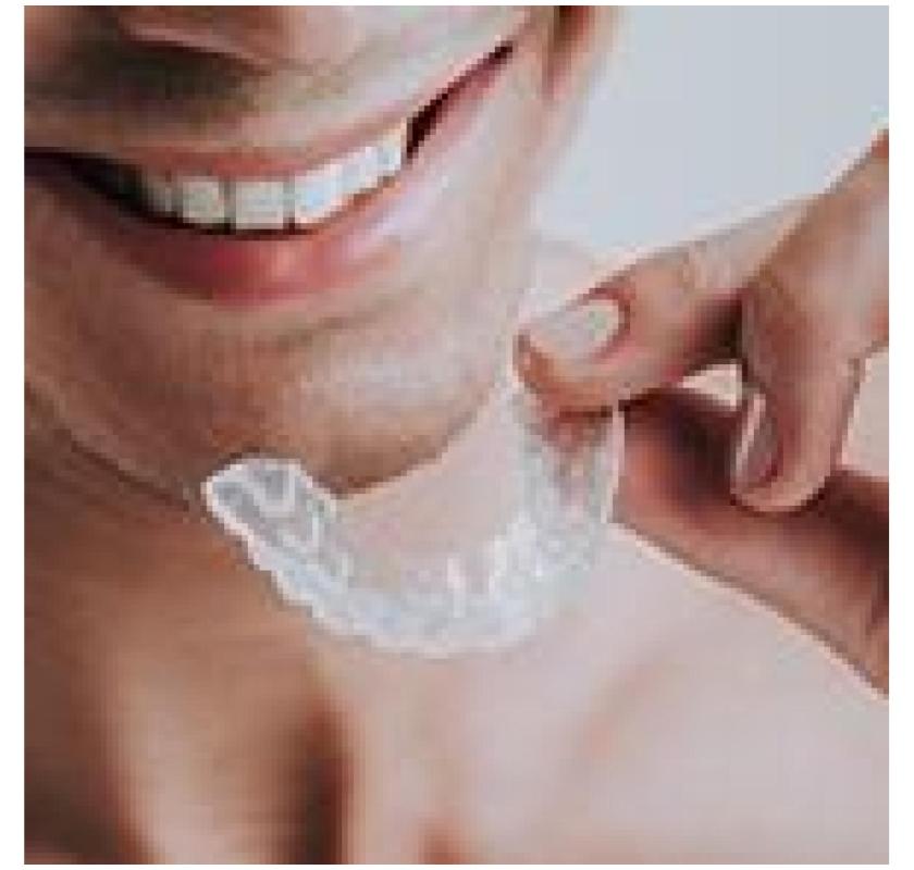 Affordable White Fillings – Restore Your Smile Today!