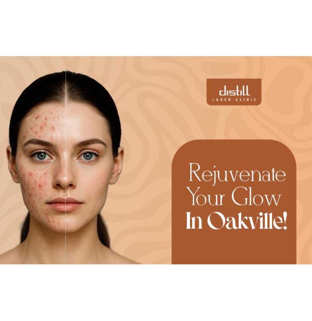 Botox Treatment For Youthful Skin In Oakville - 2/3