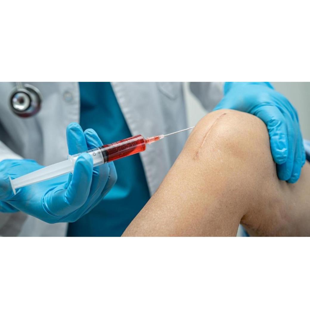 Top GAE Treatment for Knee Pain in New Jersey