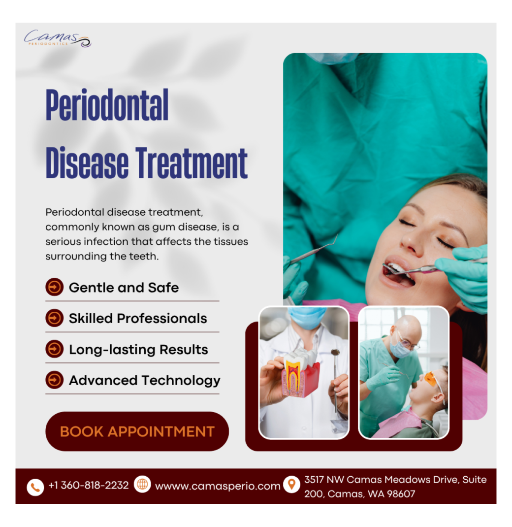 The Role of Laser Therapy in Modern Periodontal Disease Treatment !