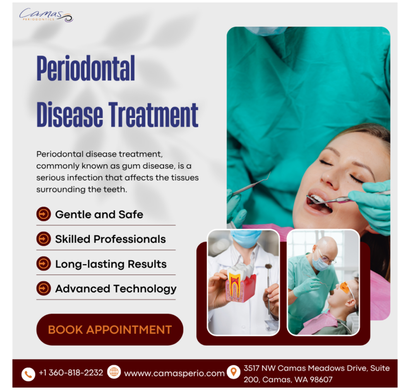 The Role of Laser Therapy in Modern Periodontal Disease Treatment !