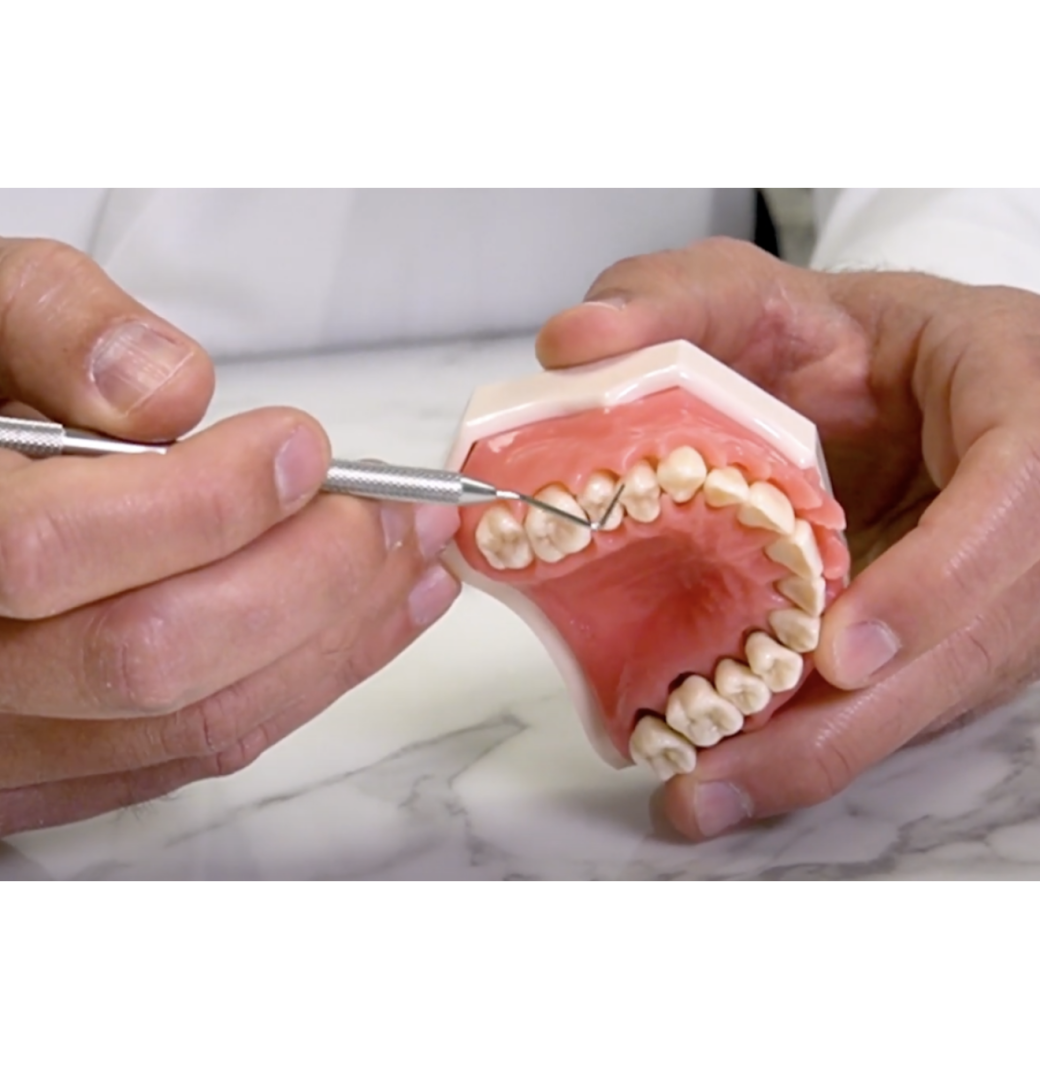 The Role of Laser Therapy in Modern Periodontal Disease Treatment ! - 2/2