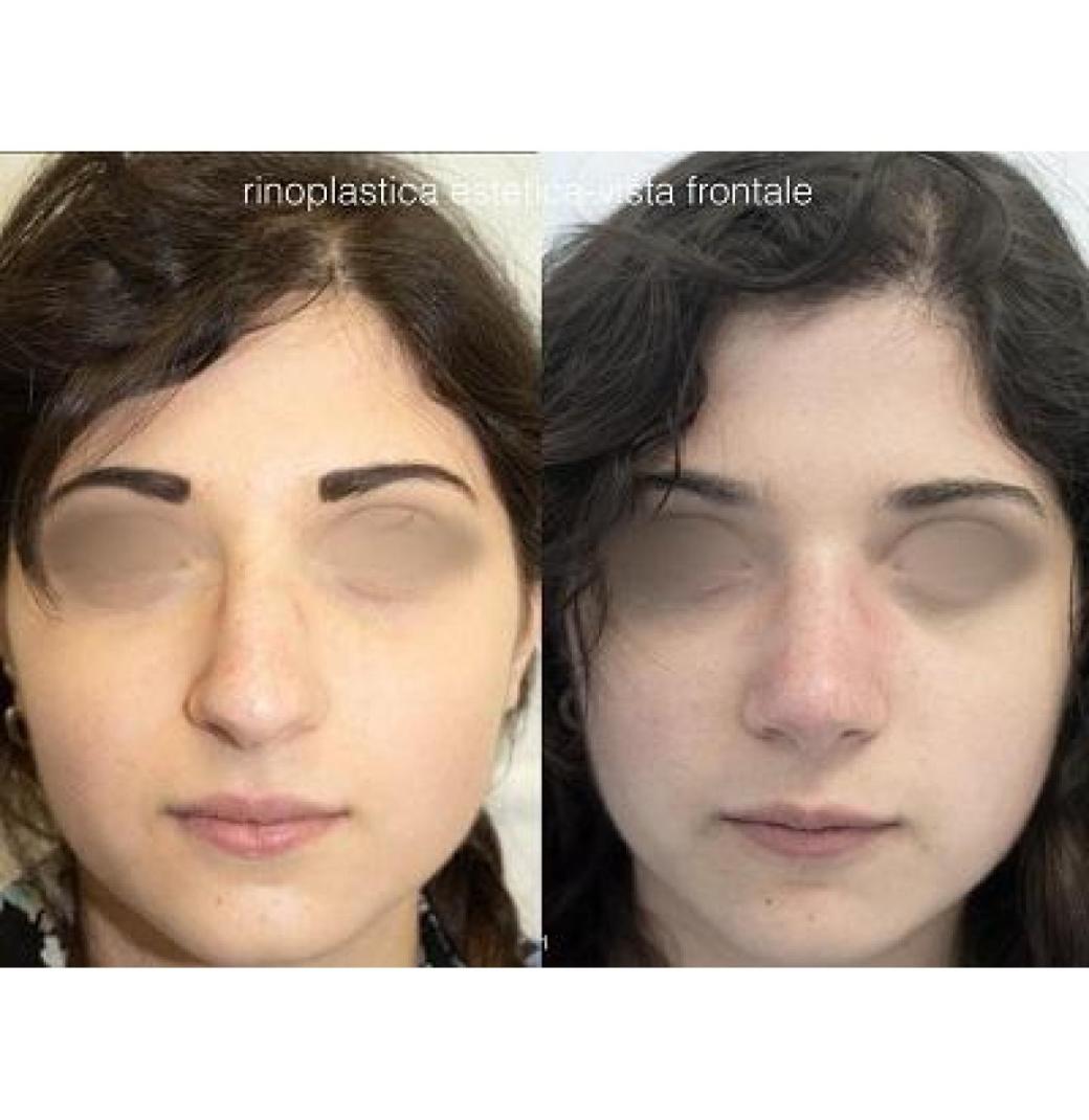 Clinica Chirurgia Estetica