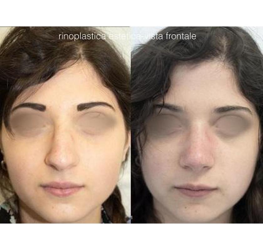 Clinica Chirurgia Estetica