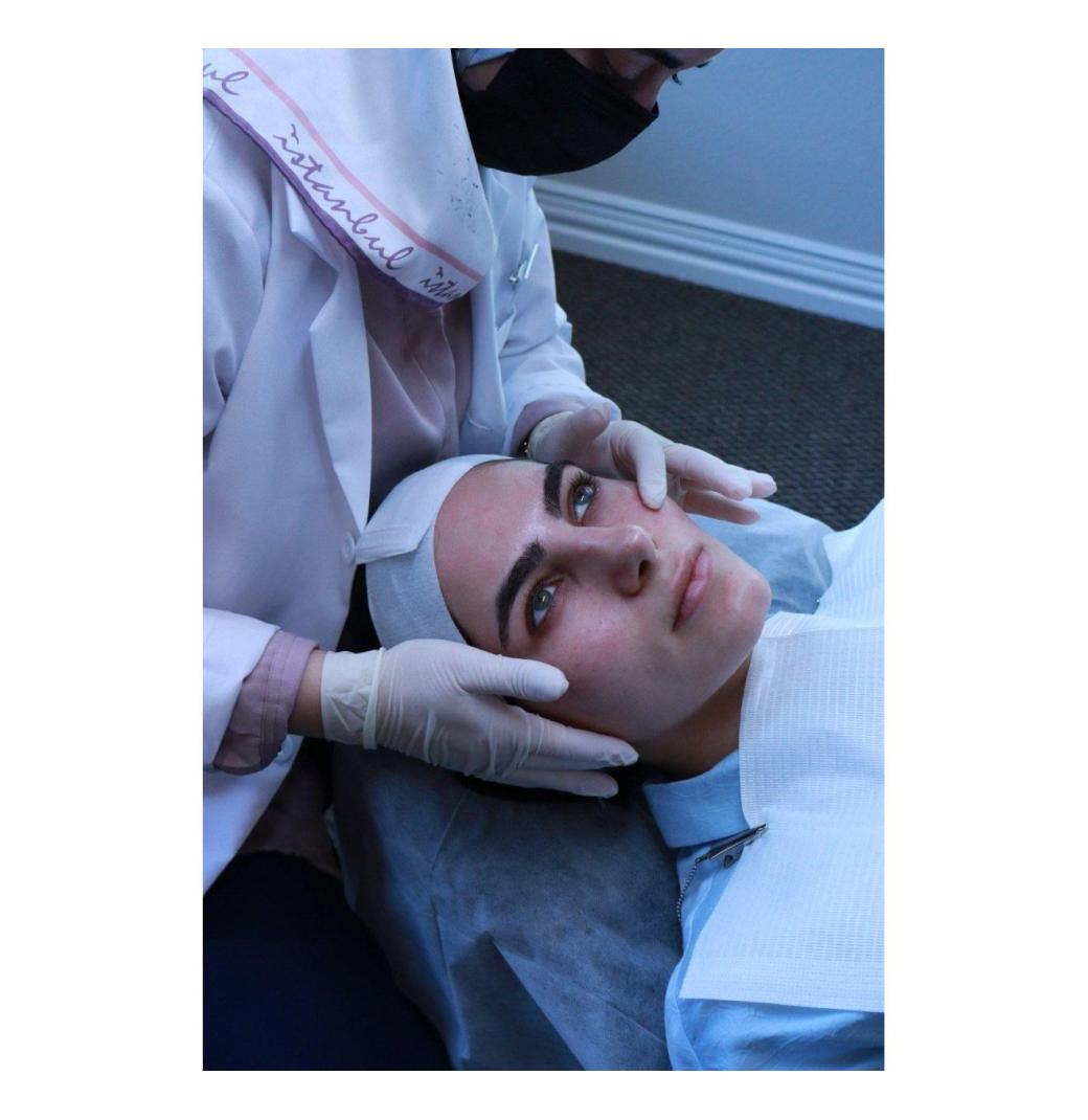 Acne Scar Treatment Dallas | Smooth, Clear Skin at Black Iris MedSpa