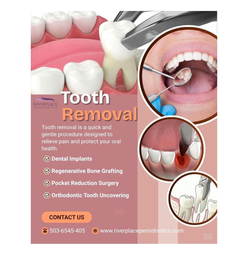 Resolve Dental Pain – Tooth Removal at Riverplace Periodpntics