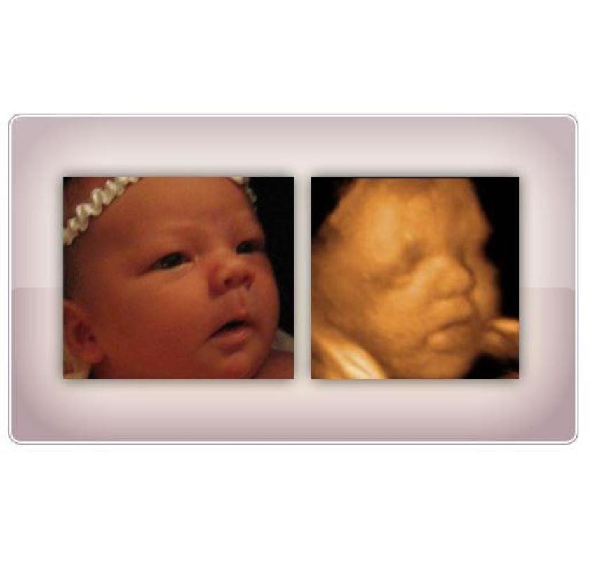 Best Gender Reveal Sonogram Near Me for a Memorable Experience