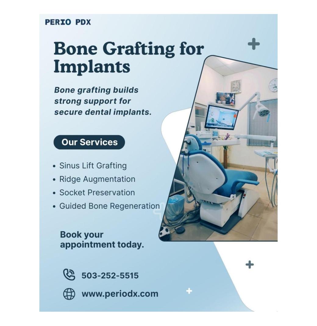  Need Bone Grafting Before Implants?