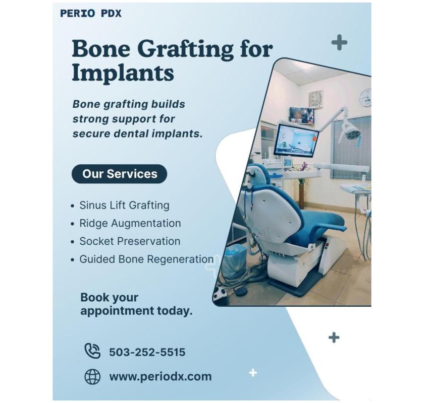  Need Bone Grafting Before Implants?