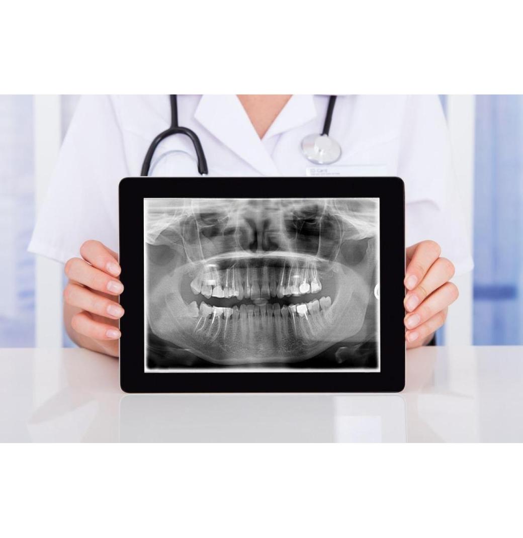 Are Digital X-Rays Safe for Kids? What Parents Need to Know ! - 2/3