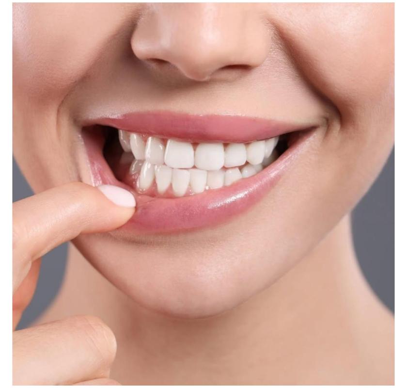 General Dentistry Services in Sea Girt NJ by Your Dentalist for Complete Oral Health 