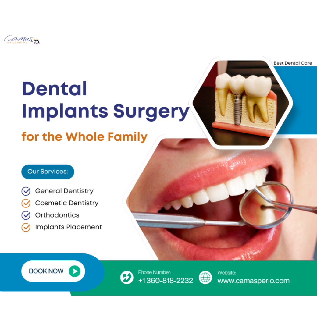  Who Is a Good Candidate for Dental Implants?