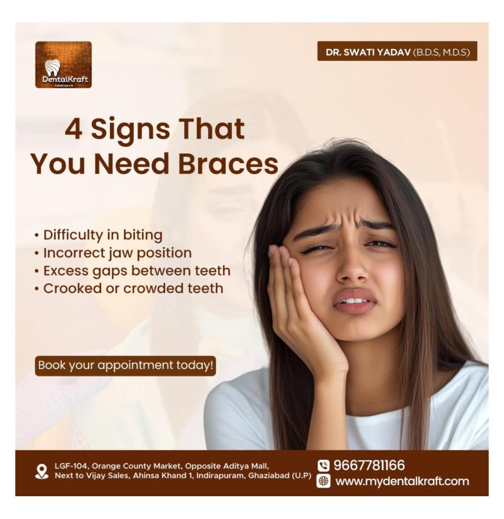 Get a Beautiful Smile With Braces treatment for teeth straightening in Indirapuram