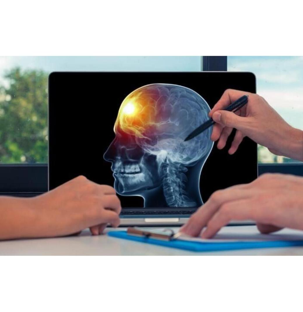 Comprehensive Brain Aneurysm Repair & Post-Surgery Care