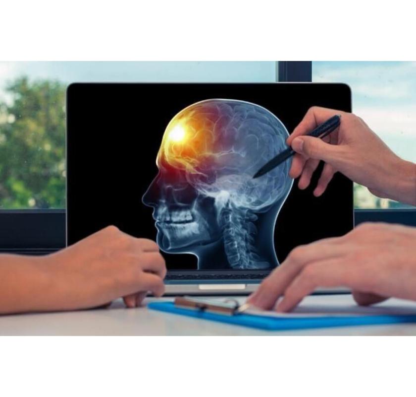 Comprehensive Brain Aneurysm Repair & Post-Surgery Care