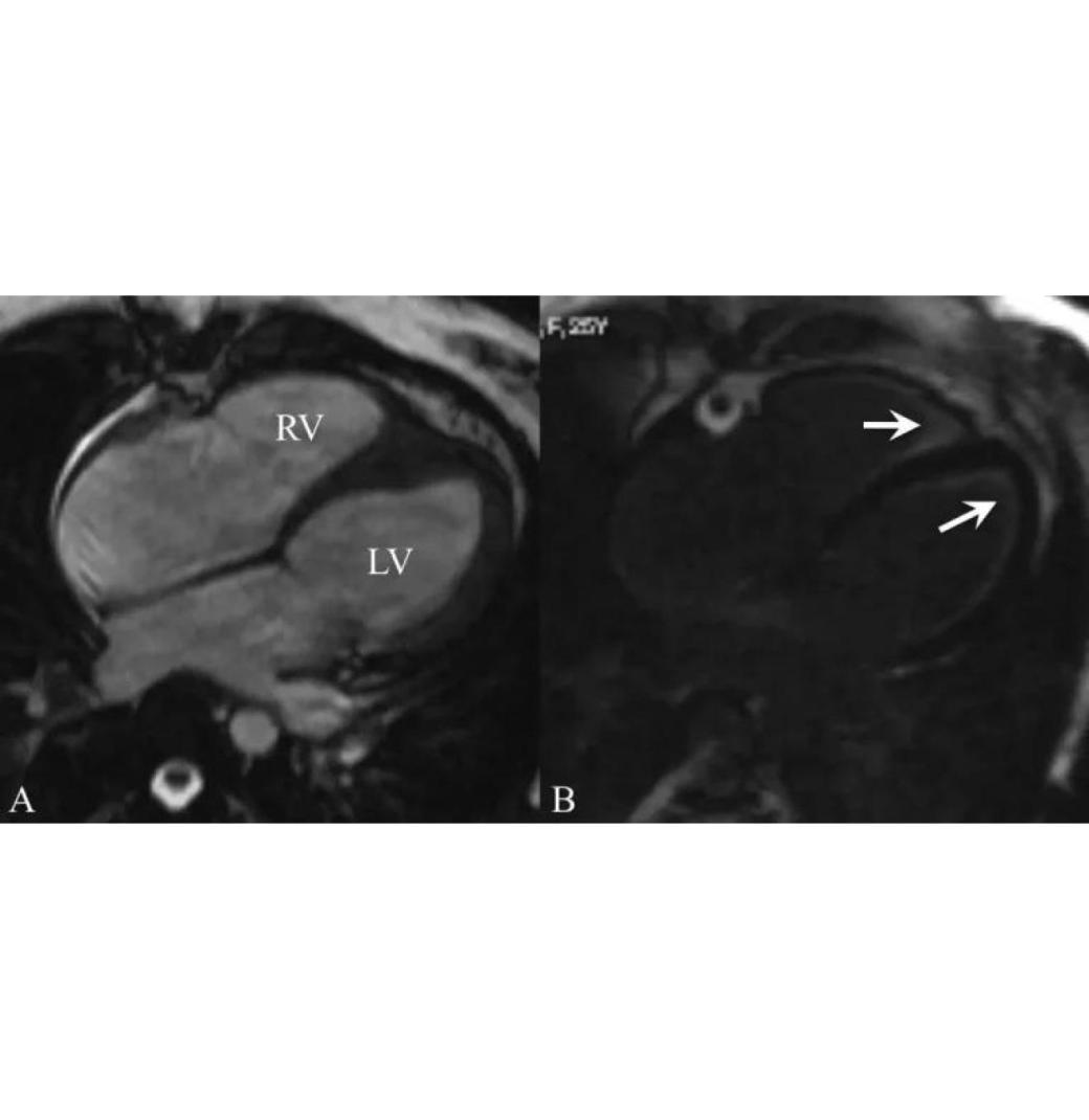 High-Resolution MRI Scan in Mumbai for Accurate Diagnosis - Picture This Imaging 