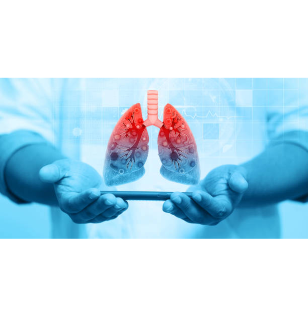 Best Lungs Doctor In Siliguri For Breathing Problems