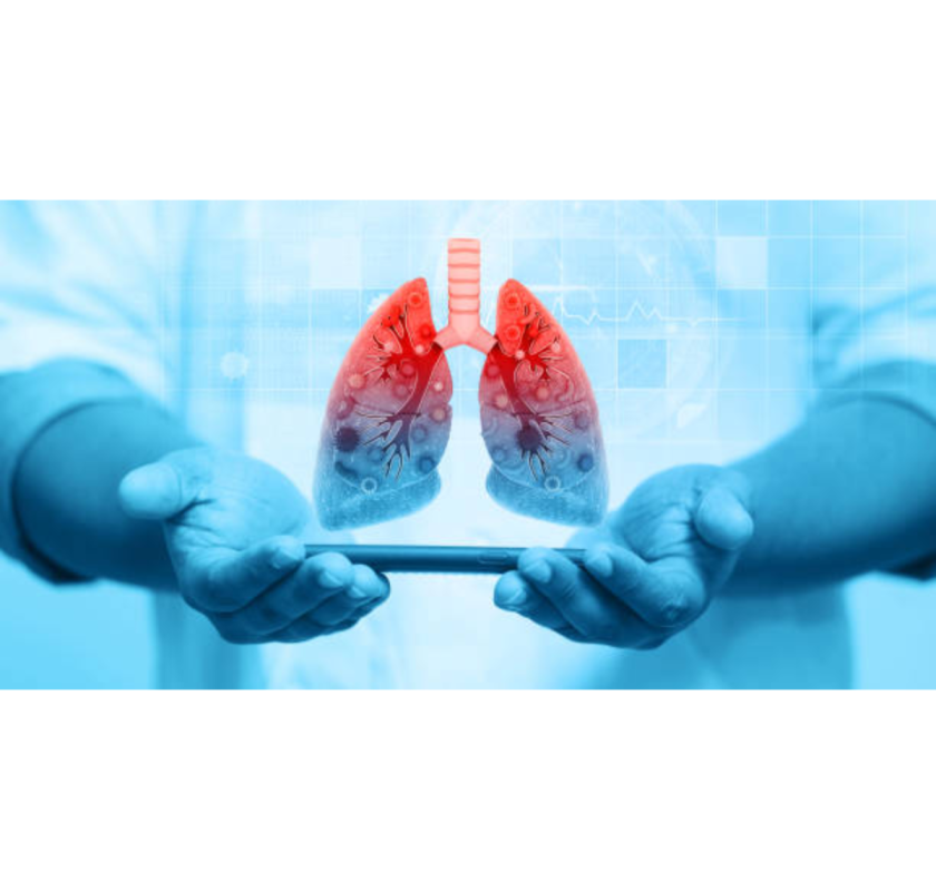 Best Lungs Doctor In Siliguri For Breathing Problems