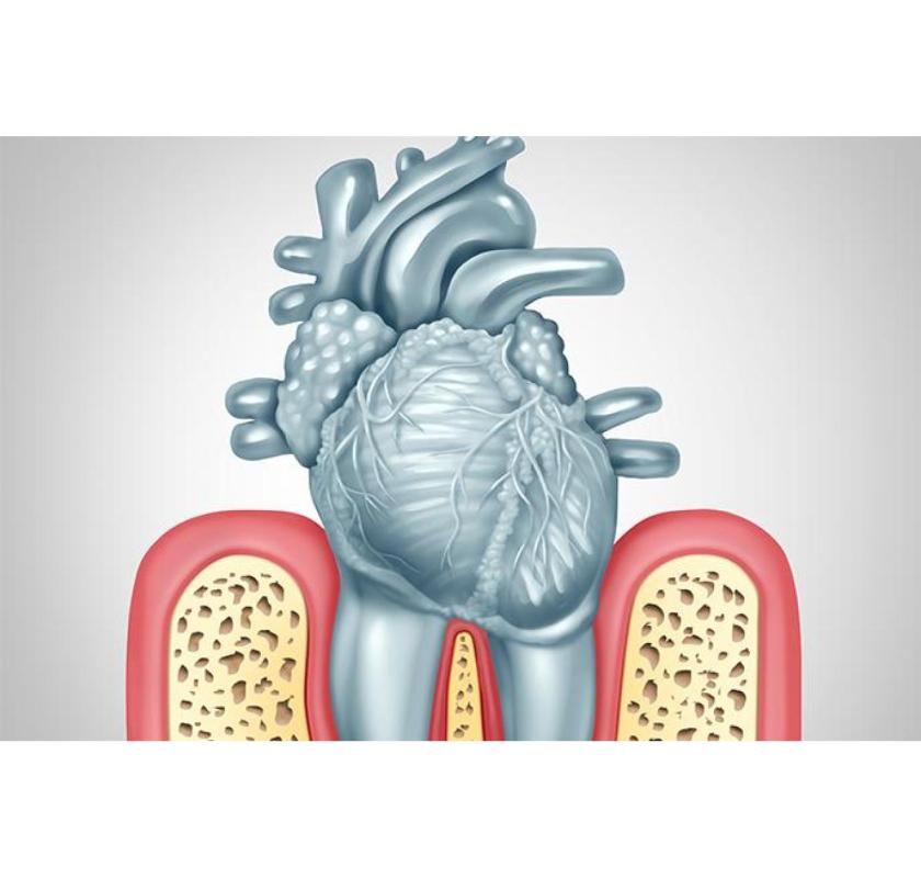 Gum Disease Treatment Melbourne CBD – Expert Care