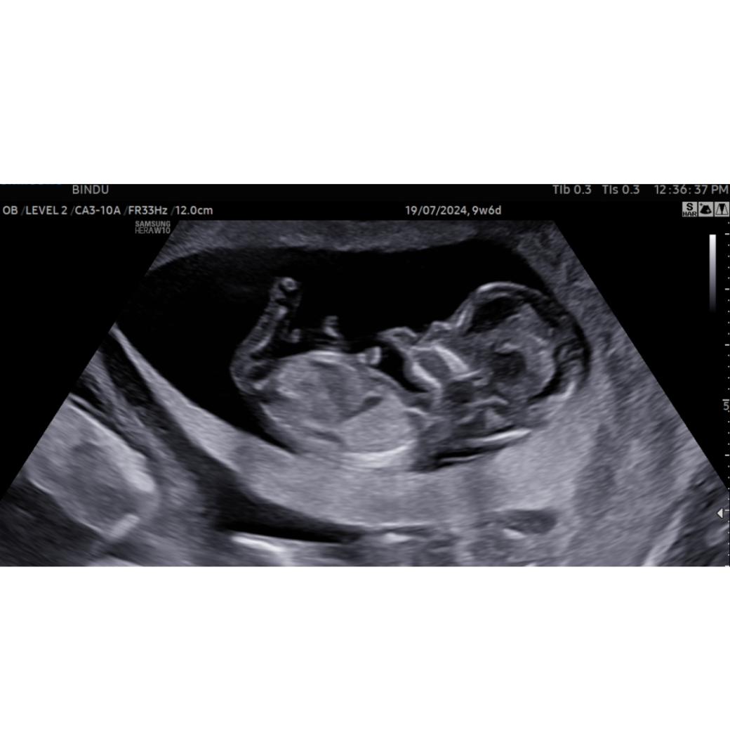 Reliable Gynae Doctor in Siliguri for Women’s Health