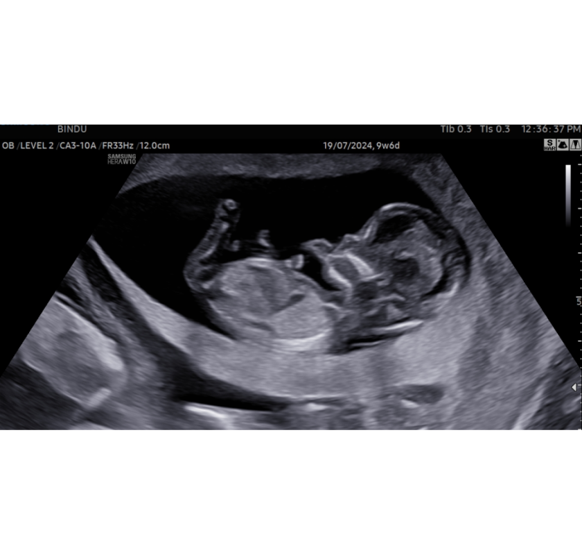 Reliable Gynae Doctor in Siliguri for Women’s Health