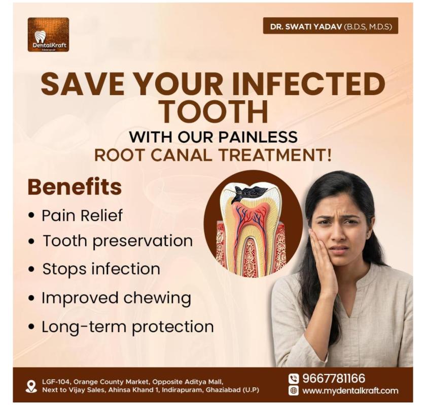 RCT clinic in Indirapuram offering precise root canal care