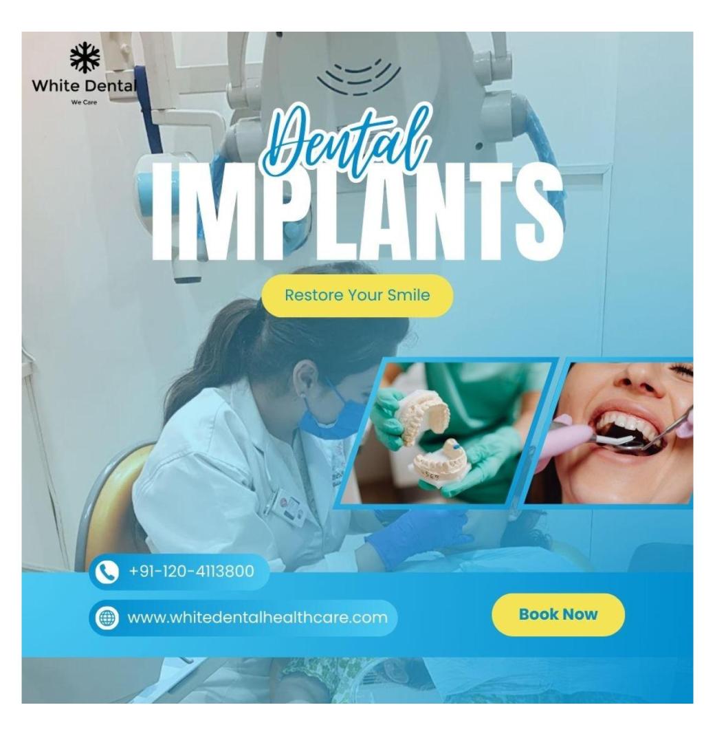 Dental implants in Indirapuram for long-lasting tooth replacement