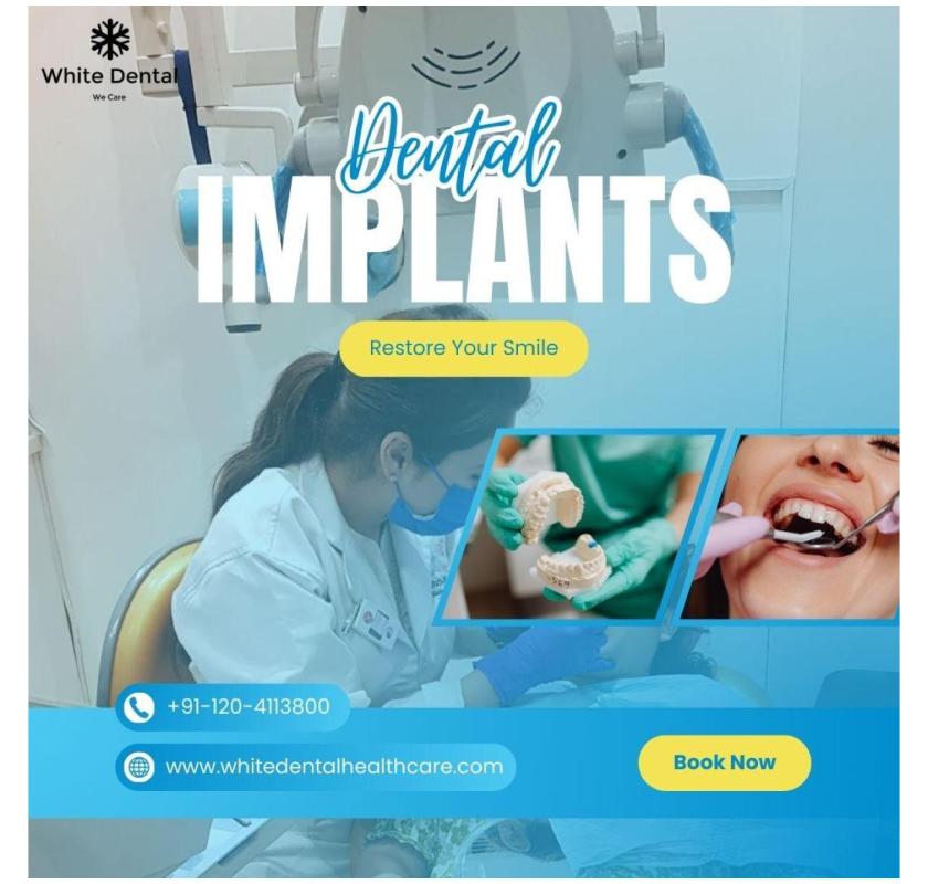 Dental implants in Indirapuram for long-lasting tooth replacement