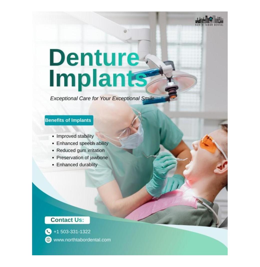 What Are Denture Implants? - 1/3