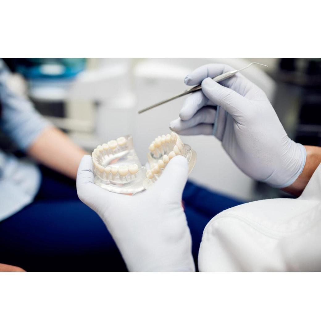 What Are Denture Implants? - 3/3