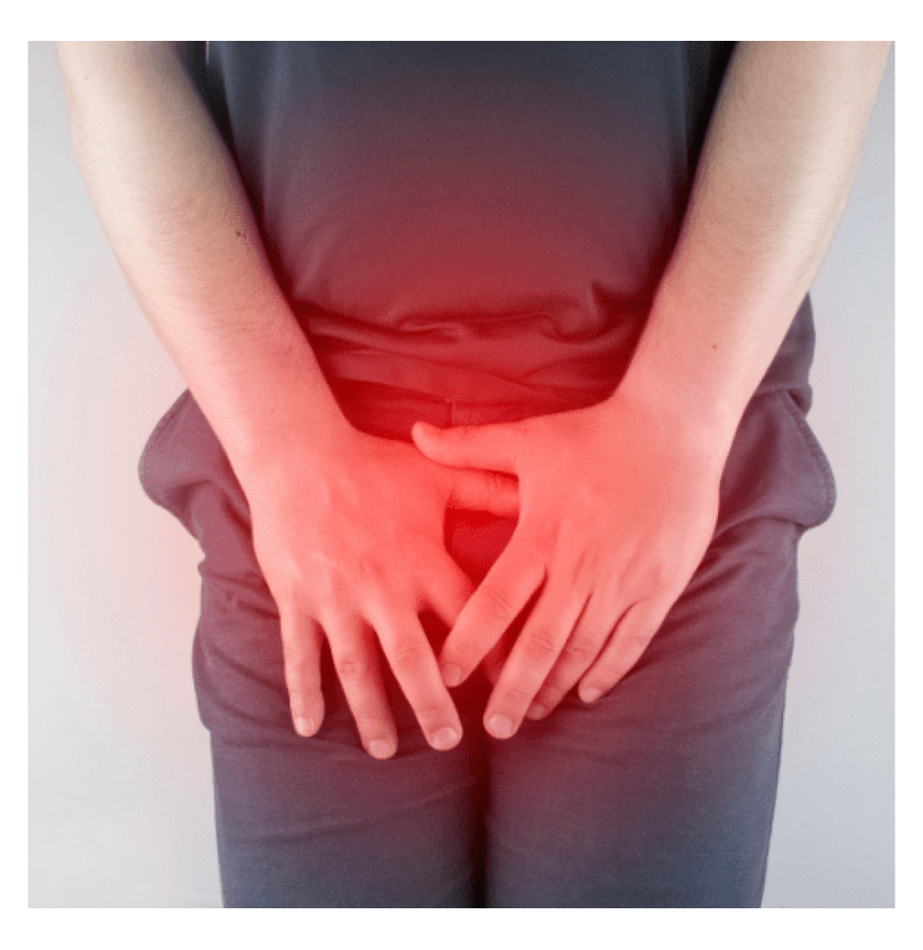 Varicocele Surgery Cost: Affordable Treatment Options & Pricing Details