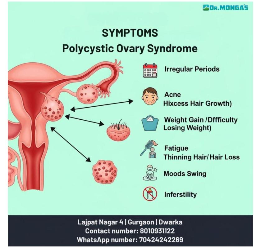 What Are the Symptoms of PCOD ?