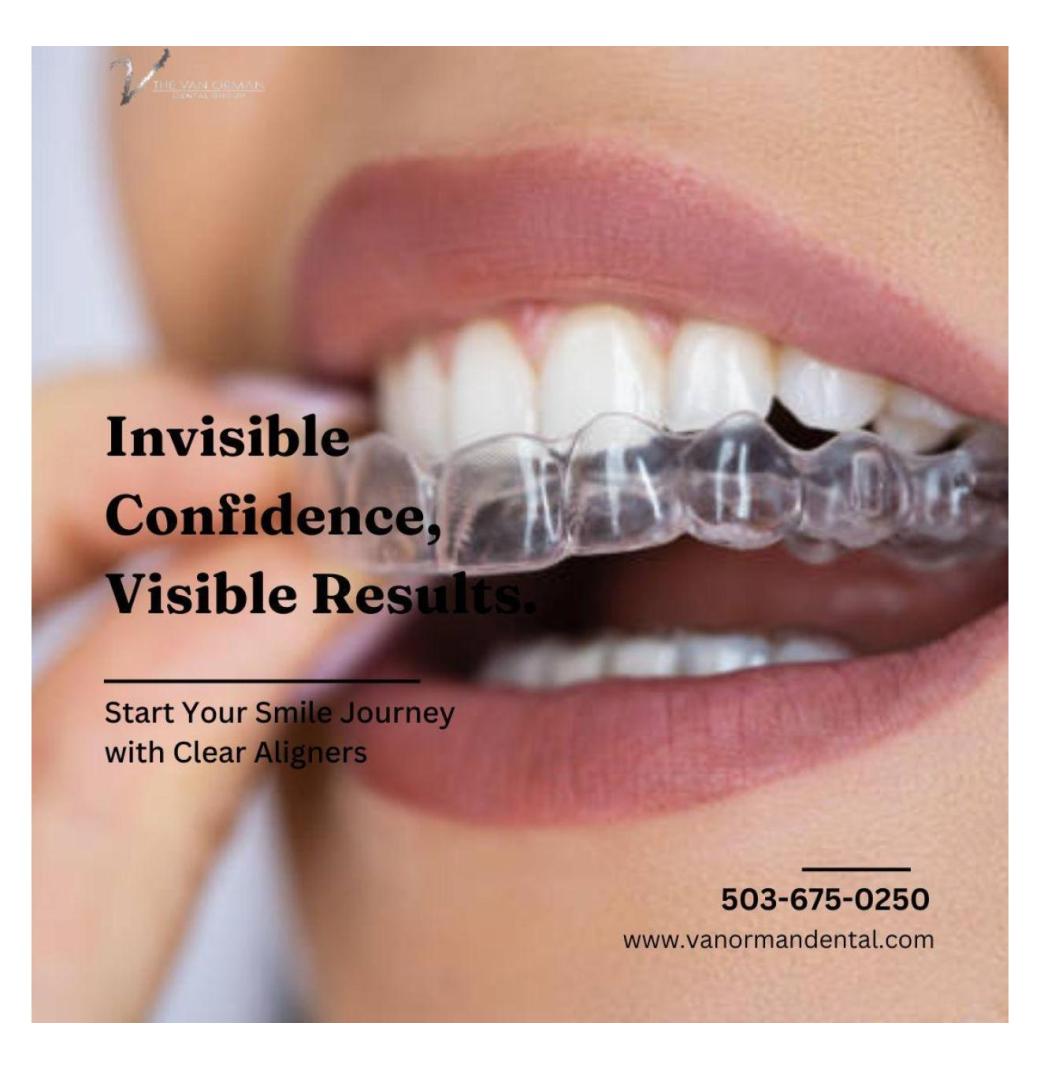 Smilers Clear Aligners for a Hassle-Free Orthodontic Experience