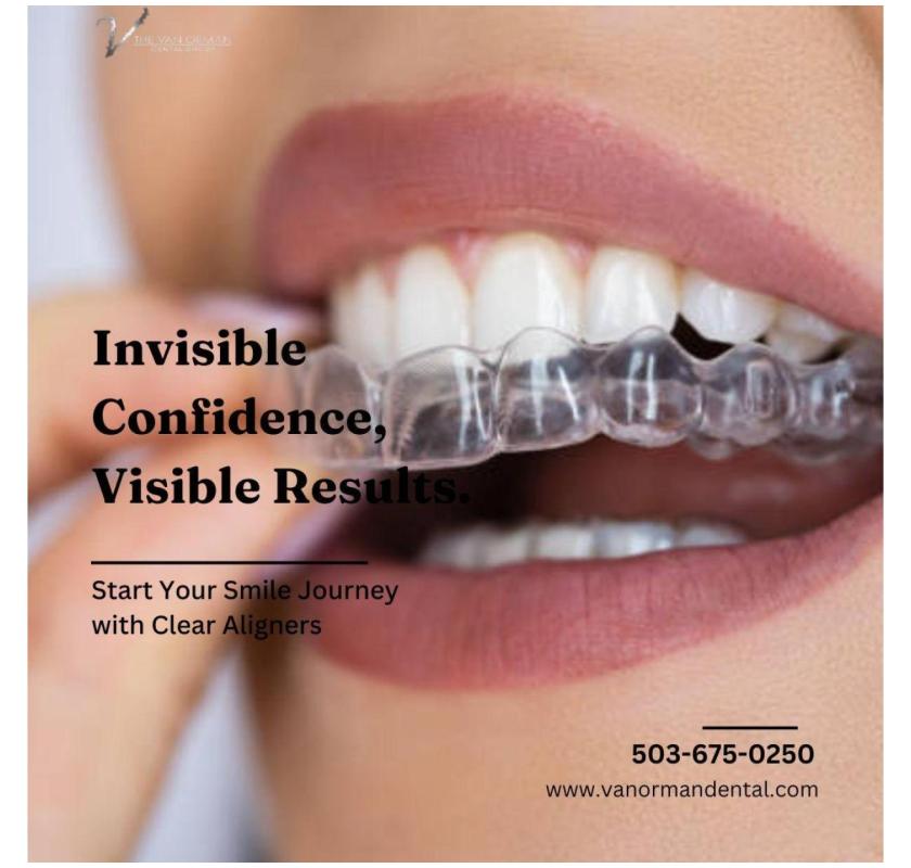 Smilers Clear Aligners for a Hassle-Free Orthodontic Experience