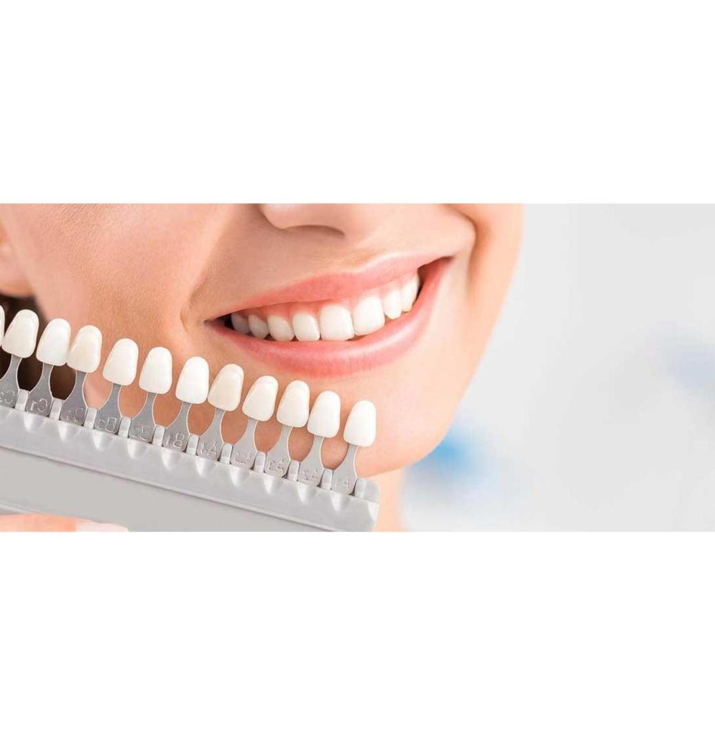 Are Denture Veneers Permanent or Removable? - 3/3