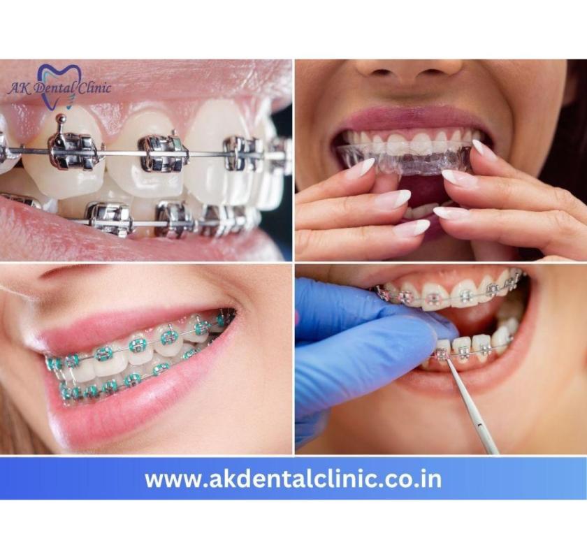 Best Dental Clinic in Vile Parle West, Mumbai | AK Dental Clinic