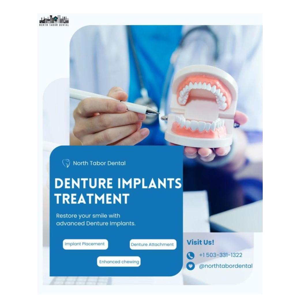 Choosing the Best Denture Implants Treatment Center Near You ! - 1/3
