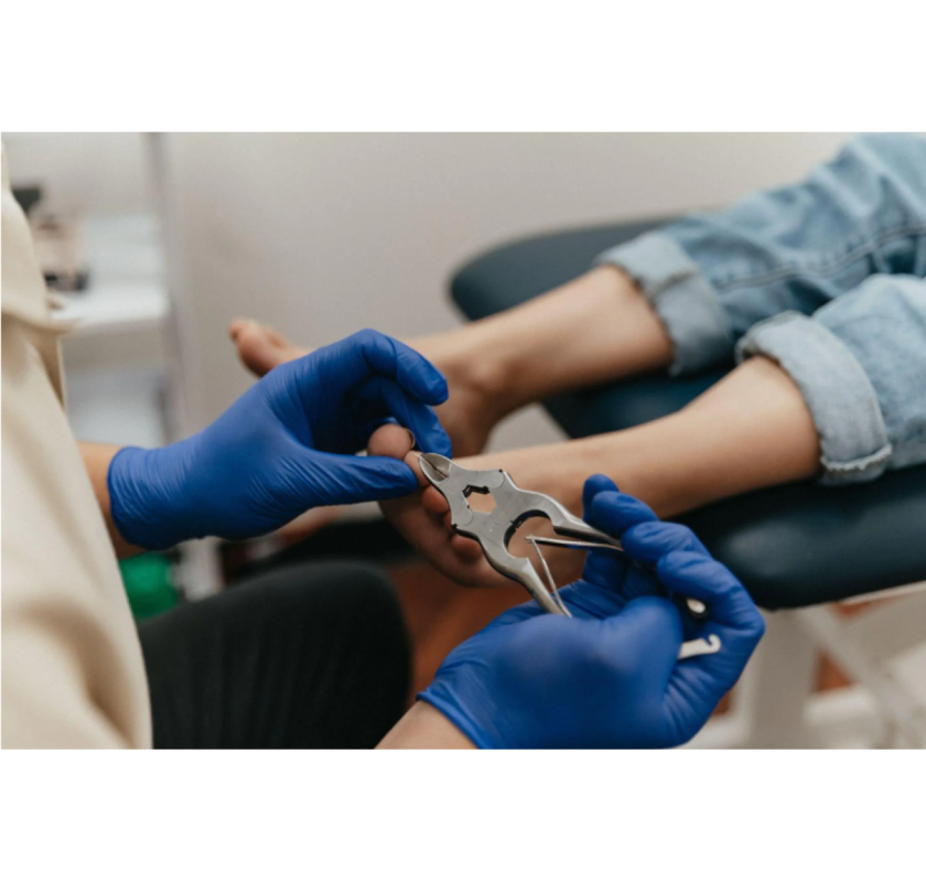 Podiatrist in Baulkham Hills | Trusted Foot Care | Local Professionals