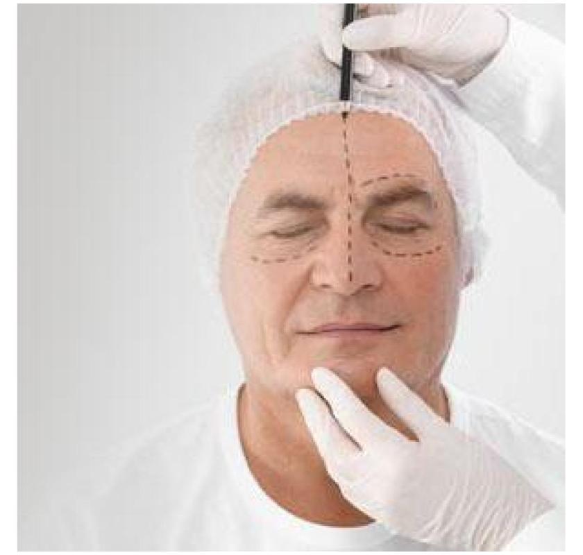 Chirurgia Estetica Viso Prezzi