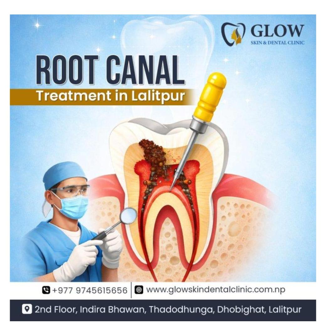 Best Root Canal Treatment in Lalitpur