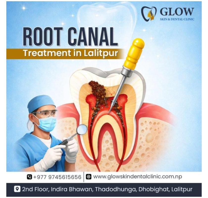 Best Root Canal Treatment in Lalitpur