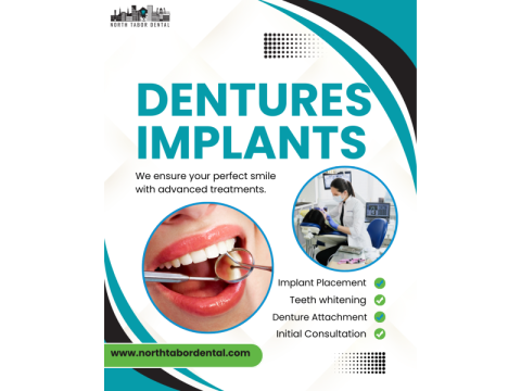 How long do dentures implants last?