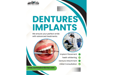 How long do dentures implants last?